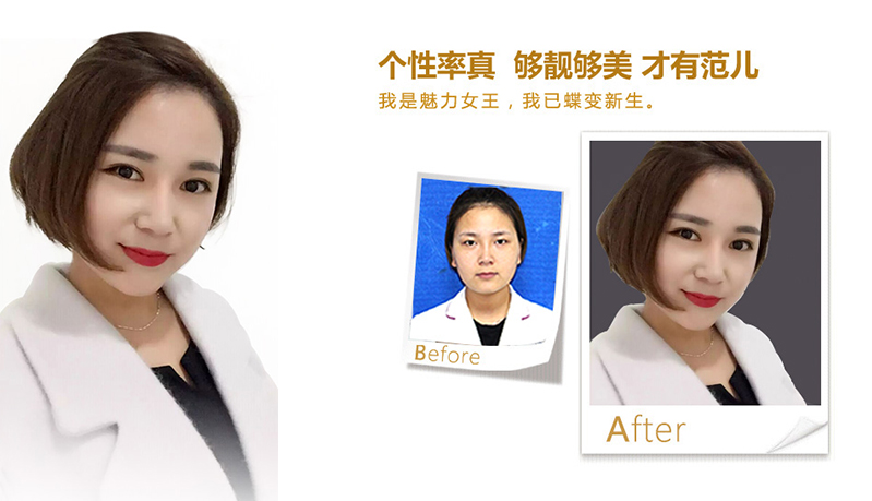 徐州美鼻、V脸